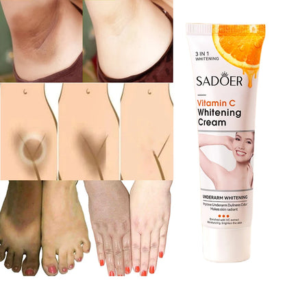 Vitamin C Brightening Body Cream for Dark Spots by HitMyNeed