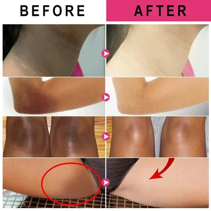 Vitamin C Brightening Body Cream for Dark Spots by HitMyNeed