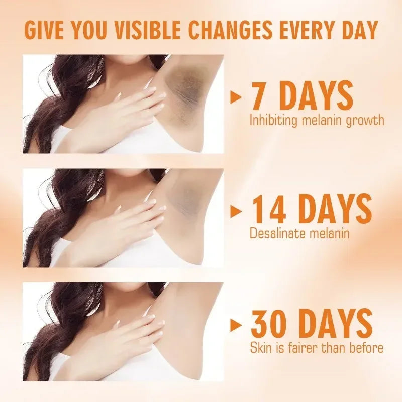 Vitamin C Brightening Body Cream for Dark Spots by HitMyNeed