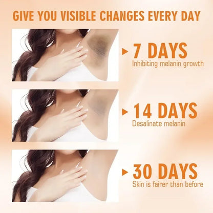 Vitamin C Brightening Body Cream for Dark Spots by HitMyNeed