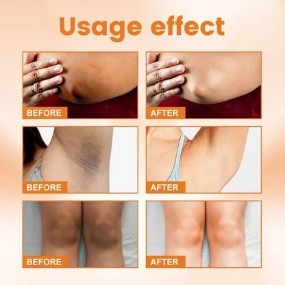 Vitamin C Brightening Body Cream for Dark Spots by HitMyNeed