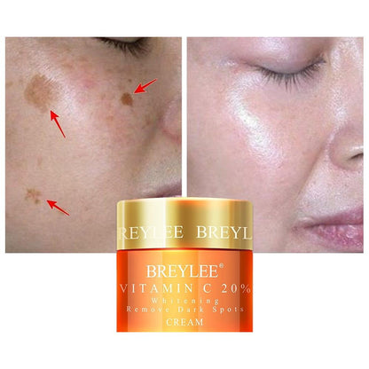 Vitamin C Dark Spot Correcting Facial Cream 20g by HitMyNeed