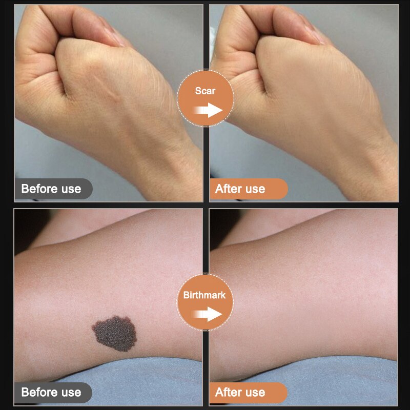 Waterproof Tattoo & Scar Concealer Cream 60ml by HitMyNeed