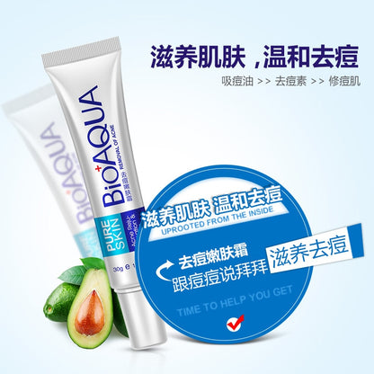 Whitening Cream Acne Treatment for Clearer Skin by HitMyNeed