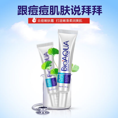Whitening Cream Acne Treatment for Clearer Skin by HitMyNeed