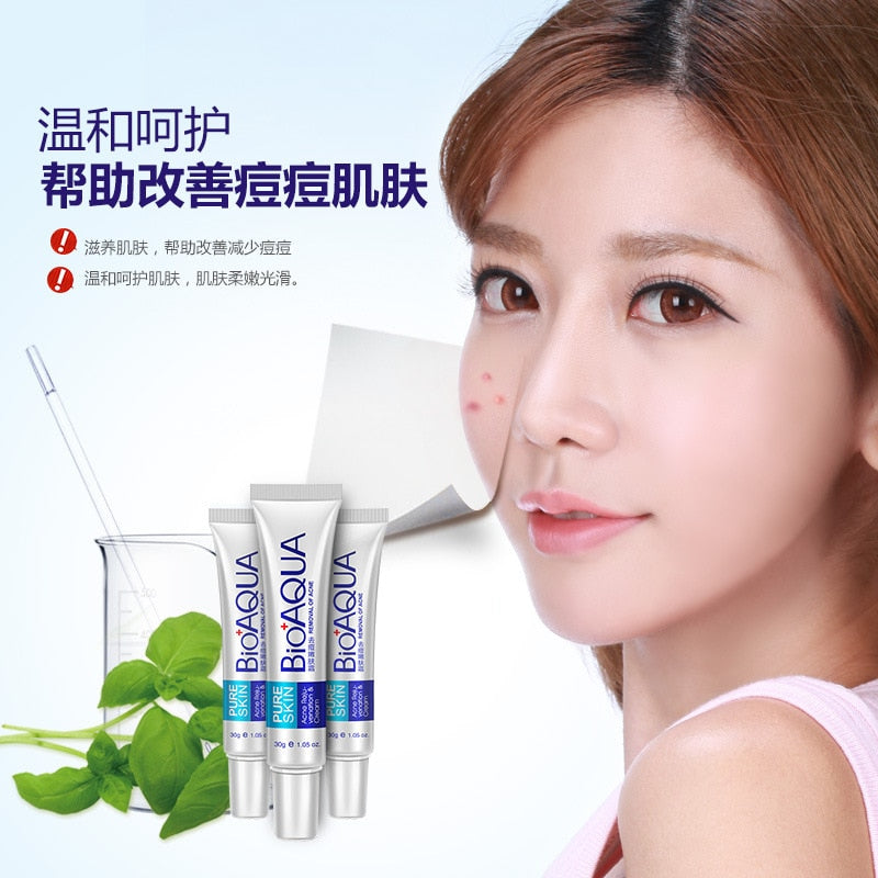 Whitening Cream Acne Treatment for Clearer Skin by HitMyNeed