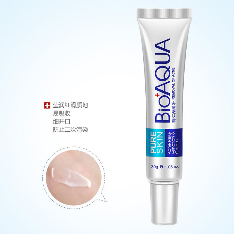 Whitening Cream Acne Treatment for Clearer Skin by HitMyNeed
