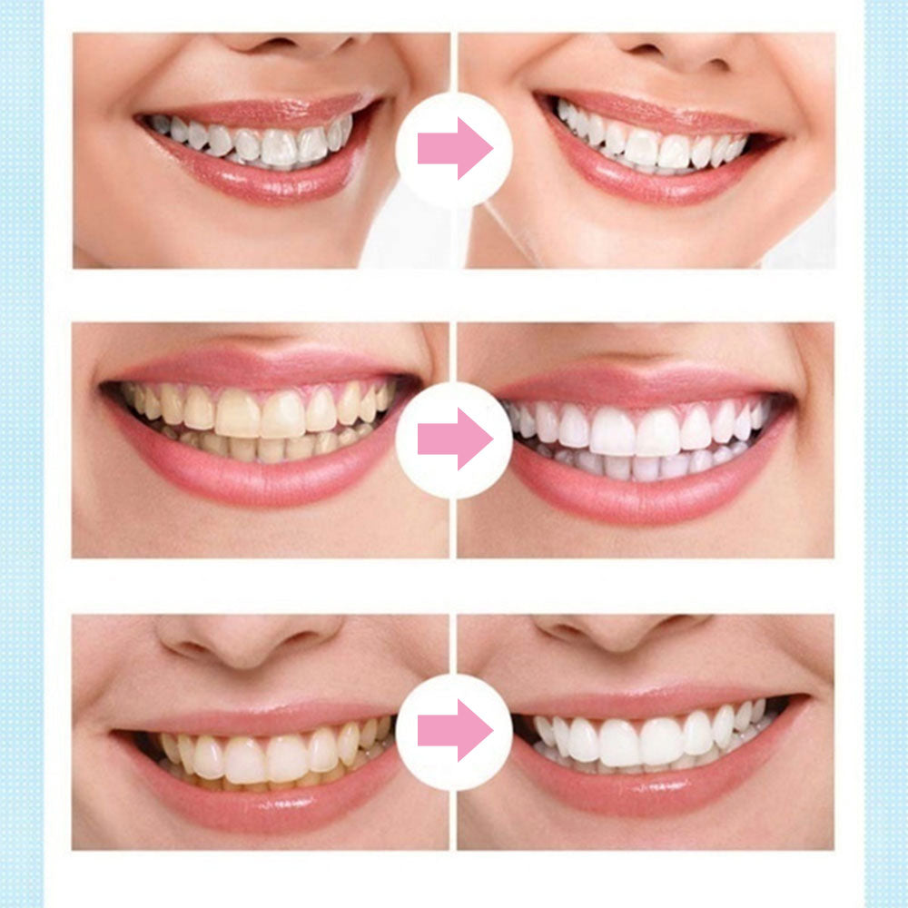 Whitening Teeth Pen with Mint Gel Applicator by HitMyNeed