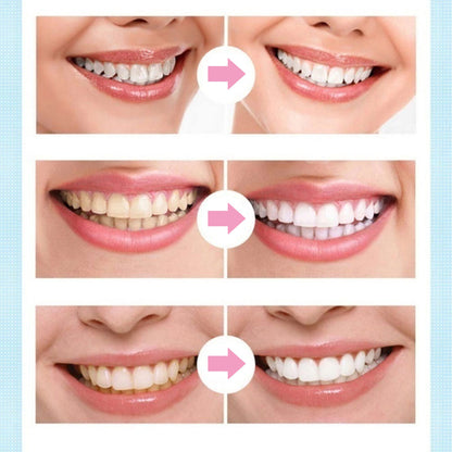 Whitening Teeth Pen with Mint Gel Applicator by HitMyNeed