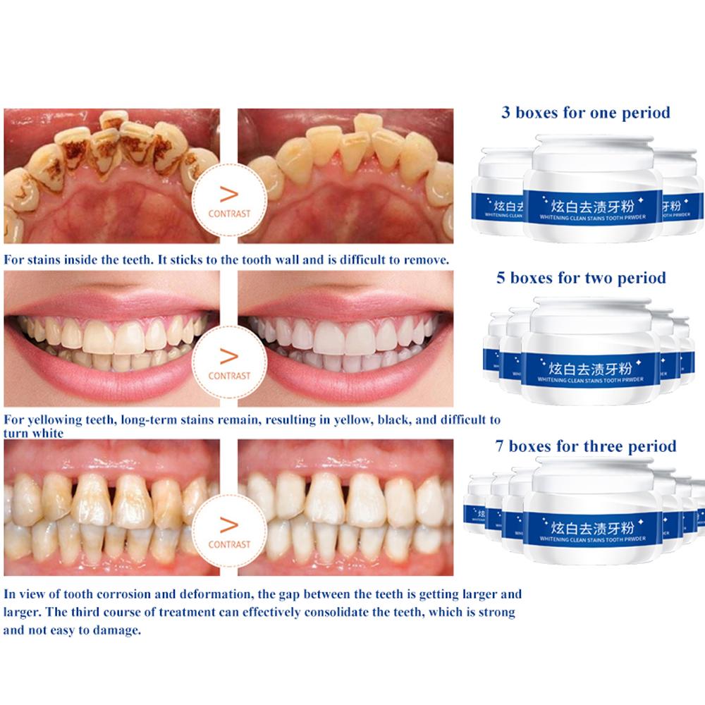 Whitening Tooth Powder 30g for Stain Removal by HitMyNeed