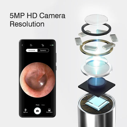 Wireless Ear Camera Otoscope with 1080P Endoscope black by HitMyNeed