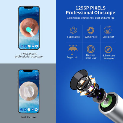 Wireless WiFi Ear Otoscope Camera with LED Light by HitMyNeed