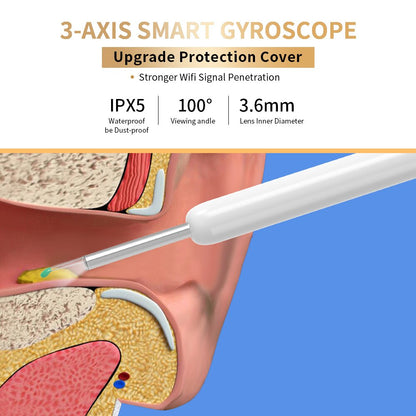 Wireless WiFi Ear Otoscope Camera with LED Light by HitMyNeed