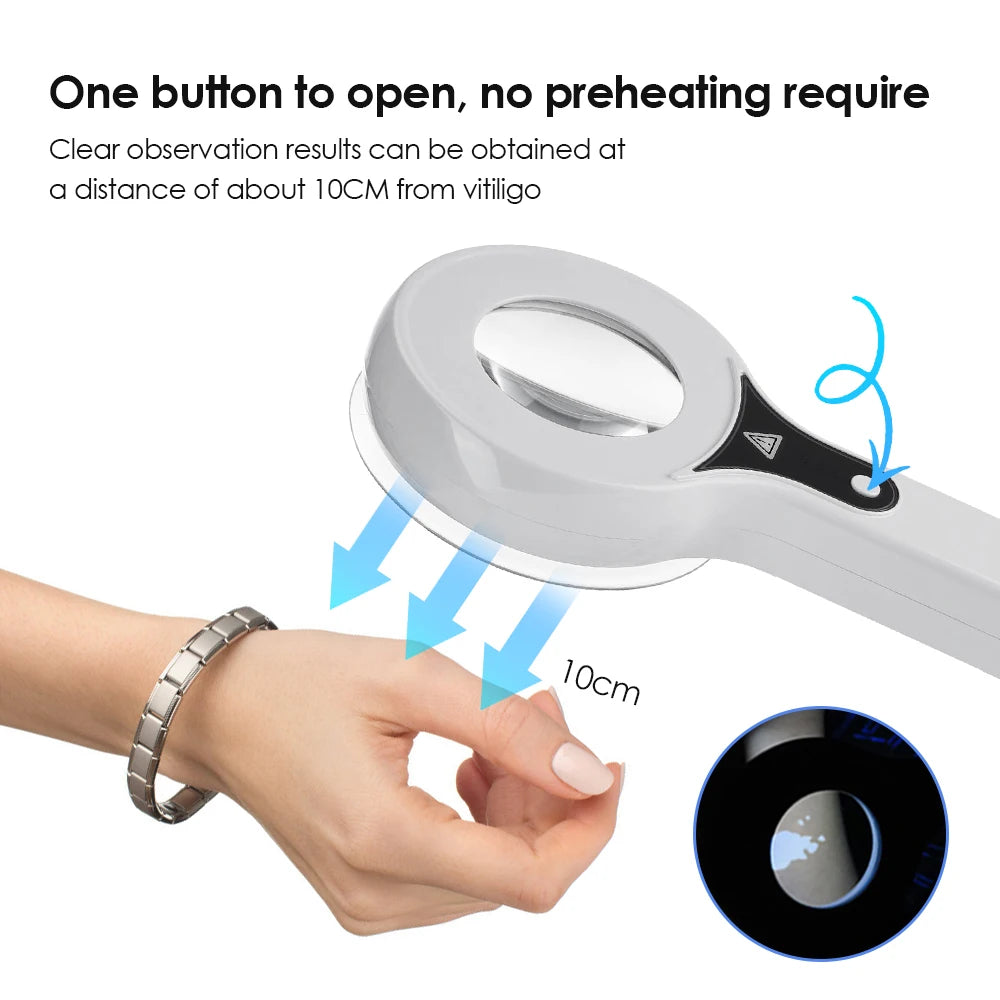 Woods Lamp UV Skin Analyzer with Magnification by HitMyNeed